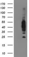 IHC-plus™ VASP Antibody (clone 4D6)