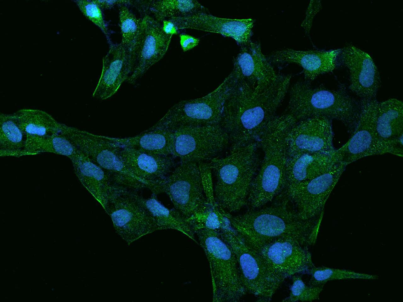 PDLIM4 / RIL Antibody