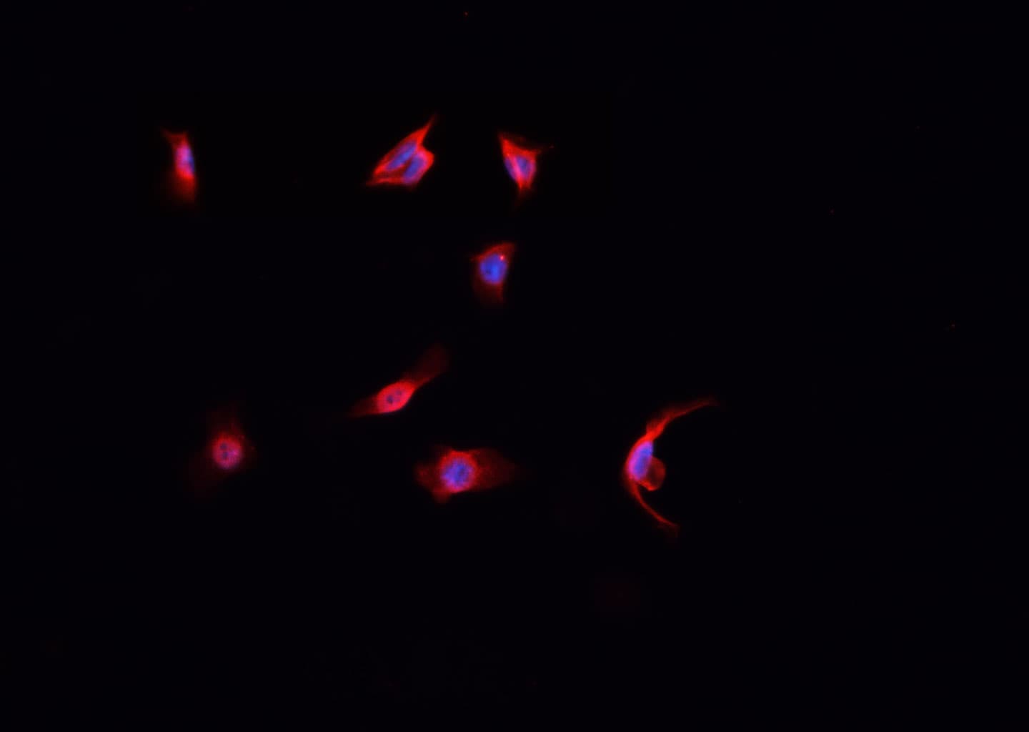 LIG4 / DNA Ligase IV Antibody