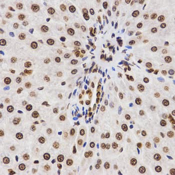 Histone H3 Antibody (Di-Methyl-Lys9)