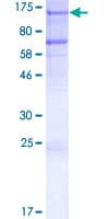 Human RBBP8 / CTIP Protein (Recombinant GST)
