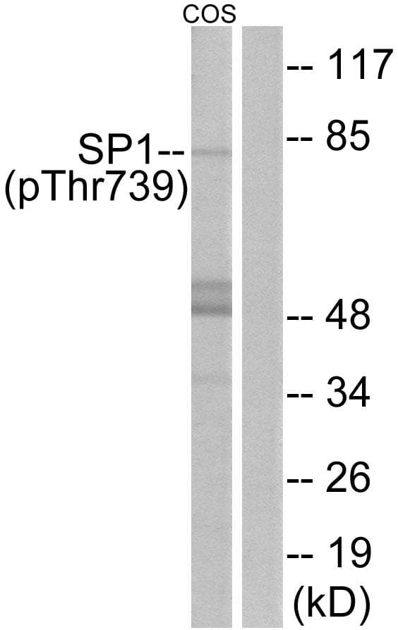 SP1 Antibody (phospho-Thr739)
