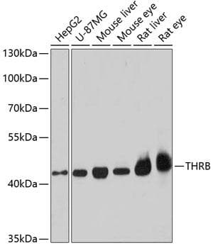 NR1A2 / THRB Antibody
