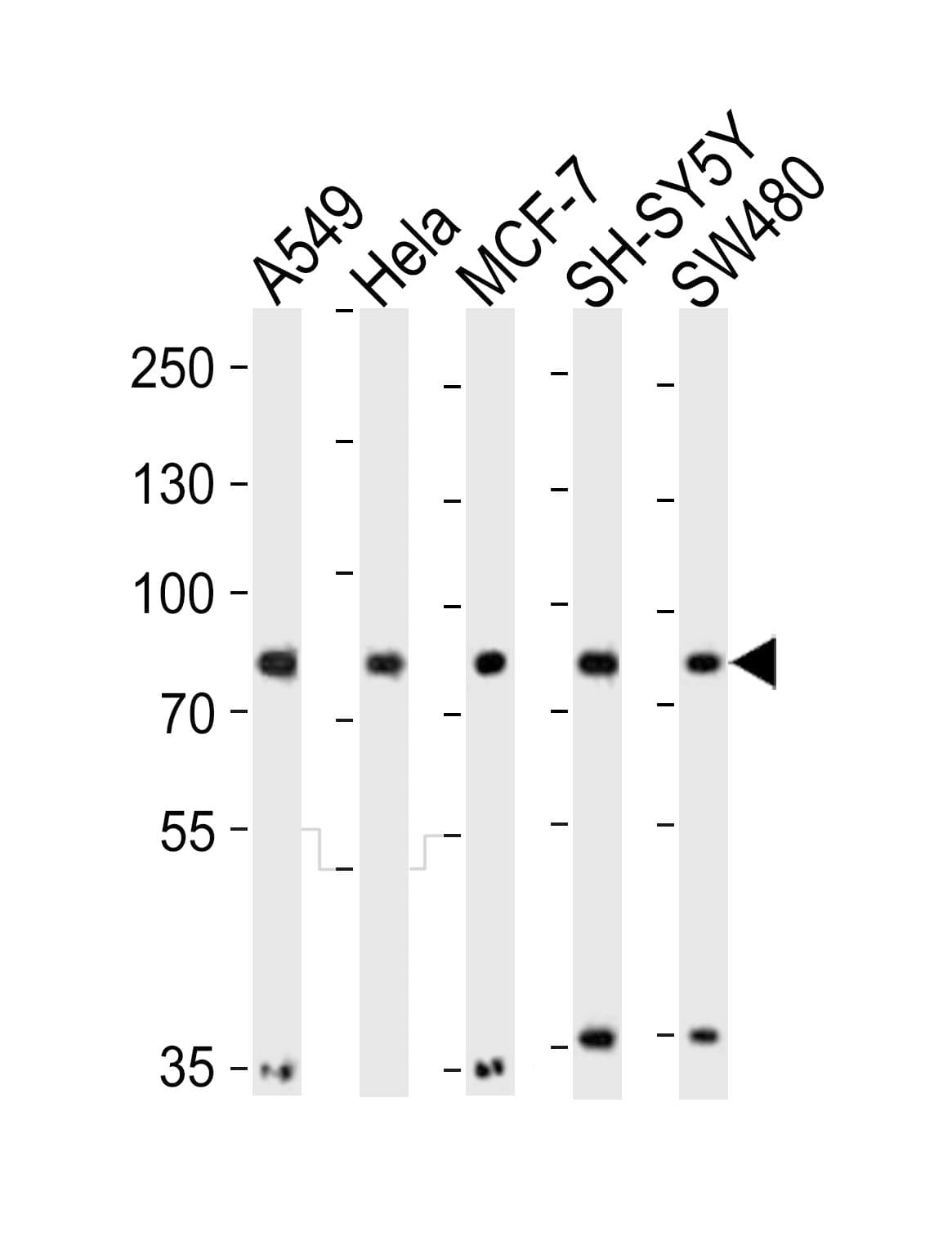 INSRR Antibody (aa668-702)