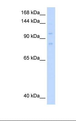 MCM8 Antibody (aa717-766)