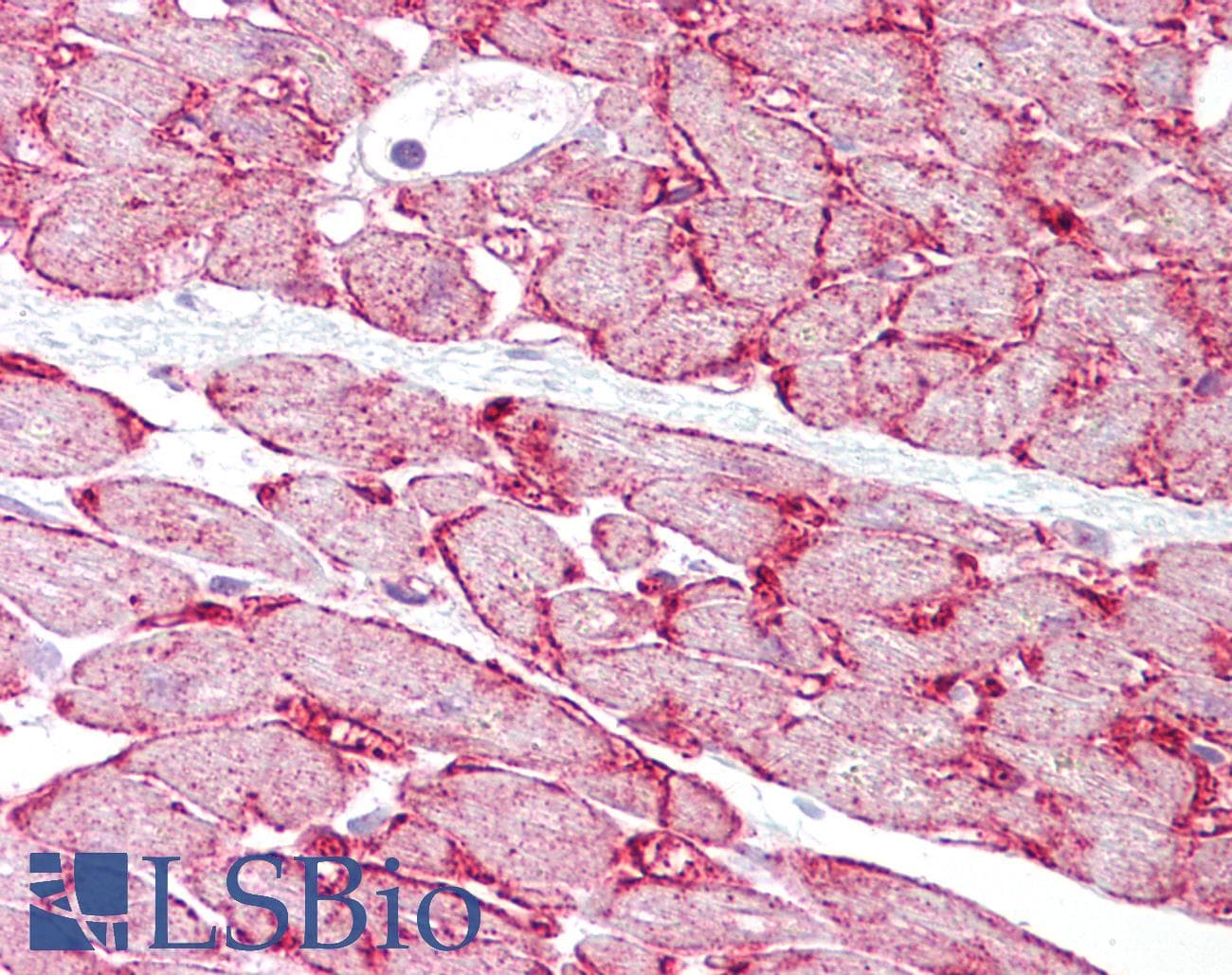 IHC-plus™ CDH13 / Cadherin 13 Antibody (aa589-617)