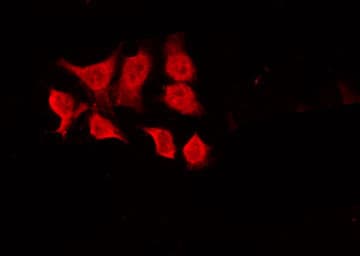 CHEK1 / CHK1 Antibody