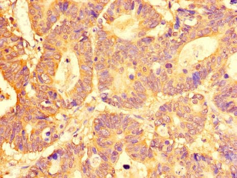 Polyclonal Rabbit anti-Human SLC29A1 / ENT1 Antibody (IHC, IF, WB)