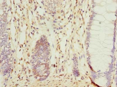 CCDC106 Antibody (Coiled-coil domain)
