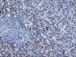 Monoclonal Mouse anti-Human STAT4 Antibody (clone OTI2F3, IHC, IF, WB)