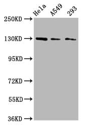 SEMA6D / Semaphorin 6D Antibody