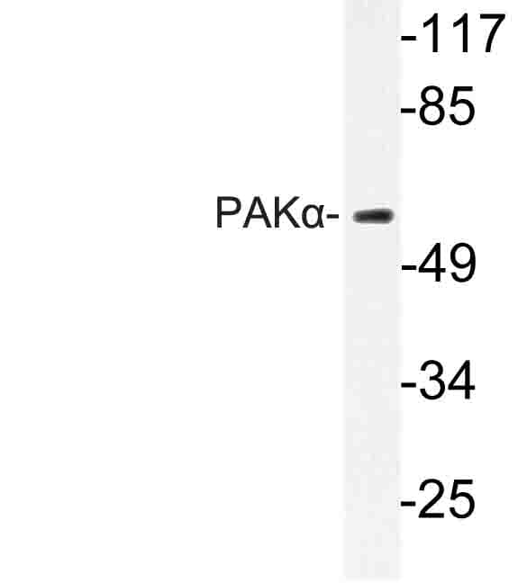 PAK1 Antibody (Glu195)