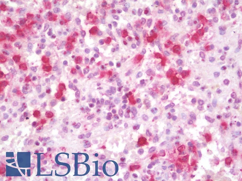 IHC-plus™ Polyclonal Rabbit anti-Human PSPLA1 / Phospholipase A1 Antibody (IHC, IF, WB)