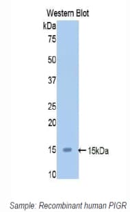 PIGR Antibody (aa19-120)