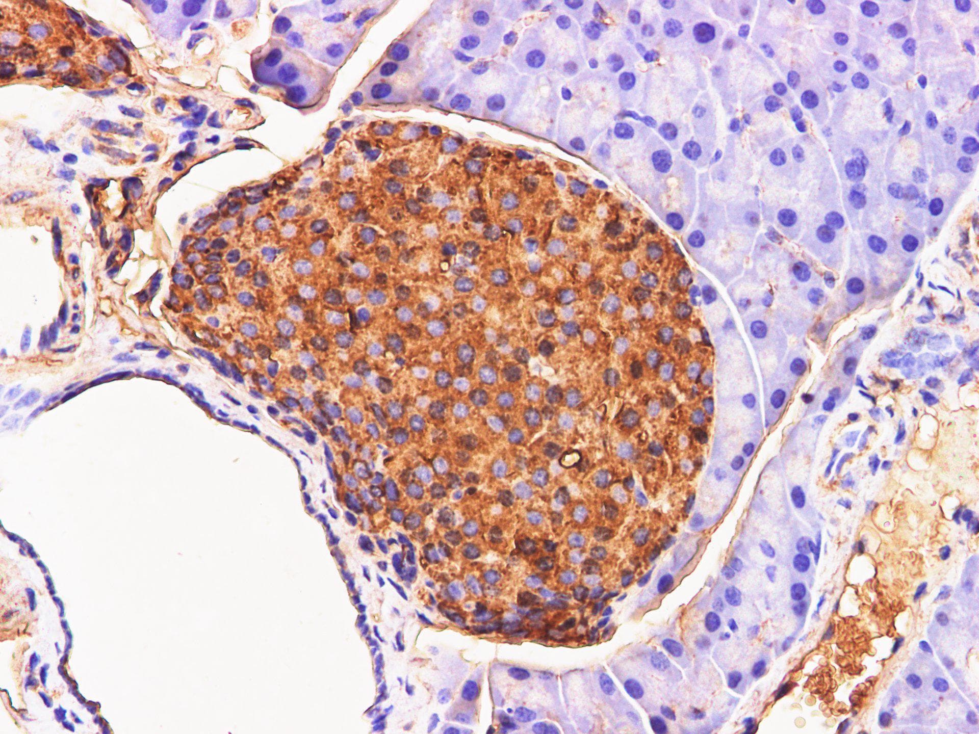 CHGA / Chromogranin A Antibody