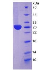 Rabbit CRP / C-Reactive Protein (Recombinant His)