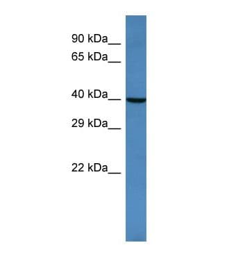 ARFGAP2 / ZNF289 Antibody (N-Terminus)