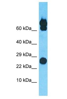 PGPEP1L Antibody (aa54-103)