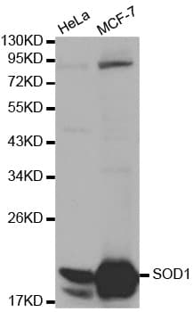 SOD1 / Cu-Zn SOD Antibody