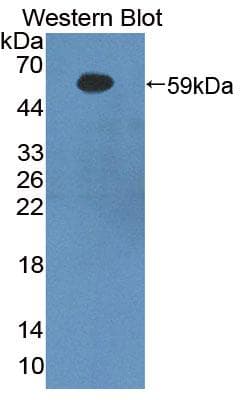 BACE1 / BACE Antibody (aa170-428, Biotin)