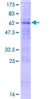Human SLC26A5 Protein (Recombinant GST)