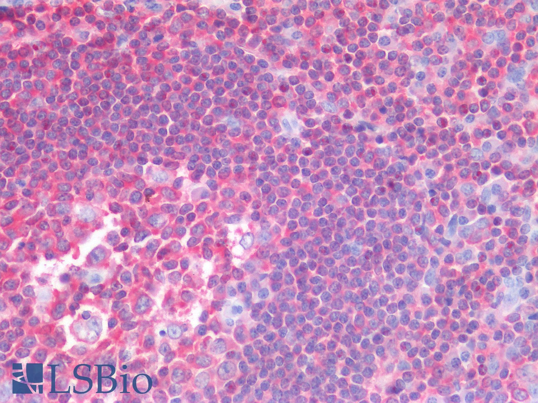 PathPlus™ Monoclonal Mouse anti-Human HCLS1 Antibody (clone 2A8, IHC, WB)