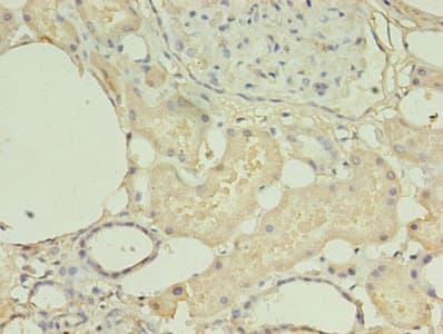 Polyclonal Rabbit anti-Human HNRNPL / hnRNP L Antibody (aa89-335, IHC)