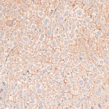CDH18 / Ey-Cadherin Antibody