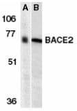 IHC-plus™ BACE2 Antibody