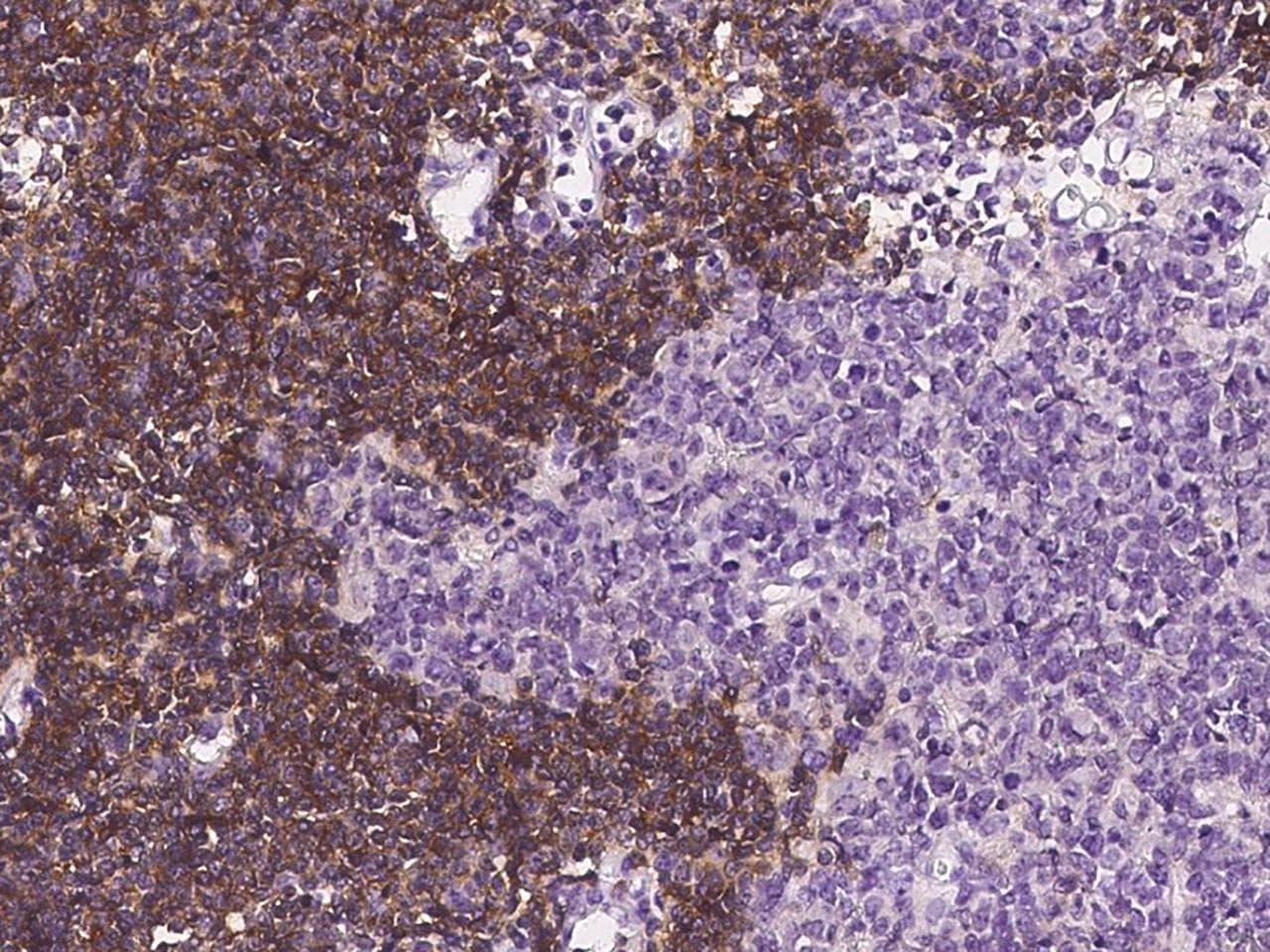 BAFF Receptor / CD268 Antibody