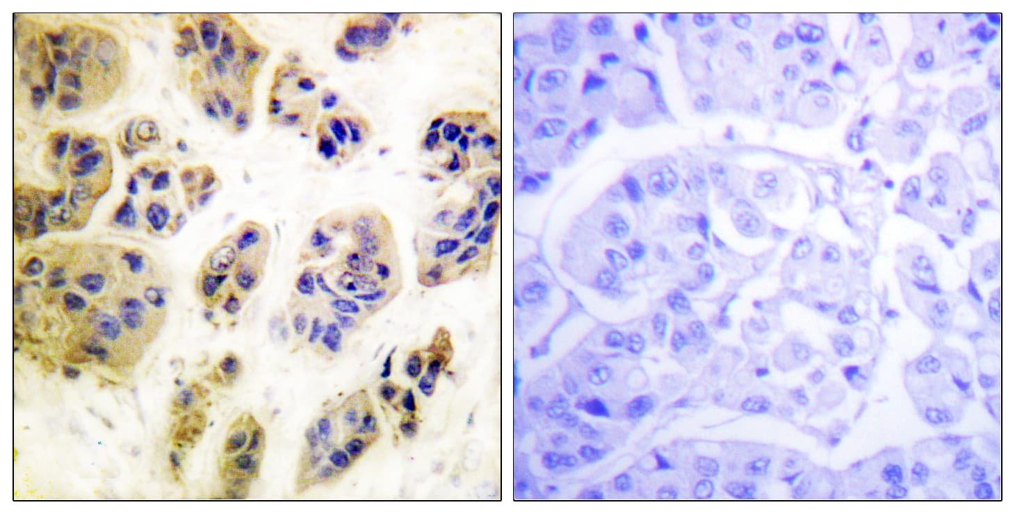 c-CBL Antibody (phospho-Tyr700)