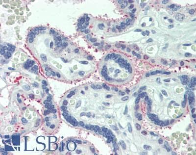 Polyclonal Rabbit anti-Human IL6R / IL6 Receptor Antibody (aa216-356, IHC, WB)