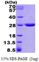 Human GSTZ1 Protein (Recombinant His)