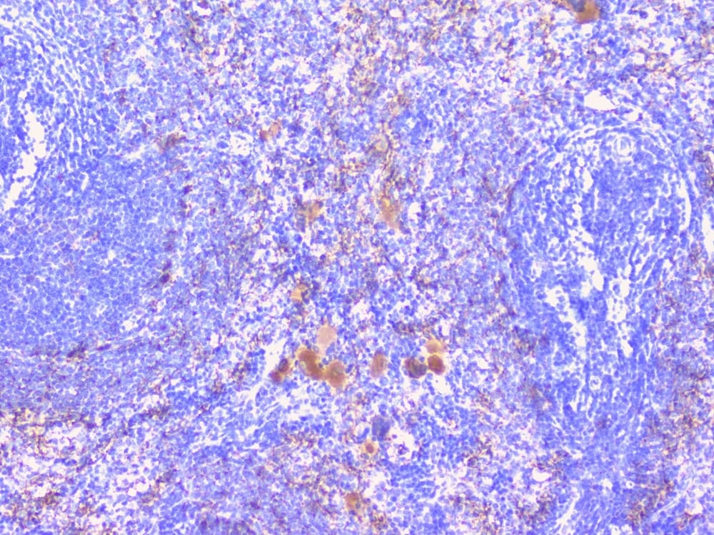 Polyclonal Rabbit anti-Human PTP1B Antibody (IHC, WB)