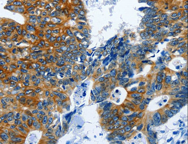 BPIFB3 / C20orf185 Antibody