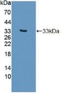PLCB2 Antibody (PE)