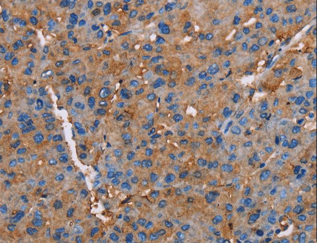 NLGN1 / Neuroligin 1 Antibody