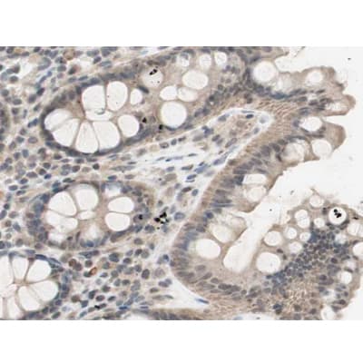 CHUK / IKKA / IKK Alpha Antibody (phospho-Thr23)