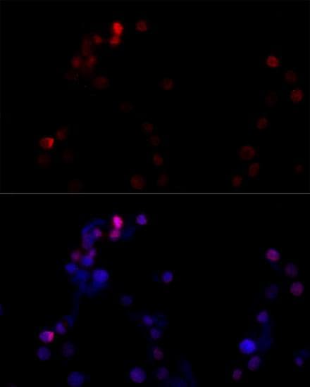 Polyclonal Rabbit anti-Human TBP / GTF2D Antibody (IF)