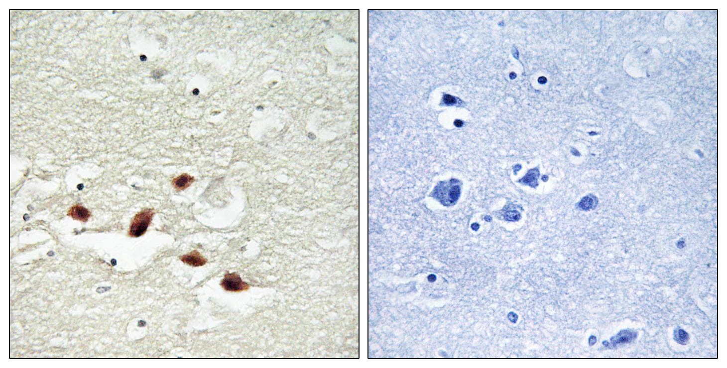 Polyclonal Rabbit anti-Human PDCD4 Antibody (Ab-67, IHC)