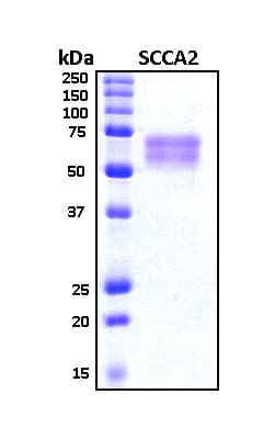 Human SERPINB4 / SCCA1+2 Protein (Recombinant 6His, N-terminus)