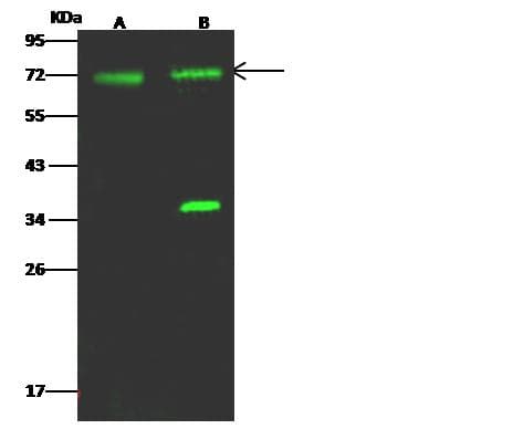 Polyclonal Rabbit anti-Human ACSS3 Antibody (Preservative Free, IHC, WB)
