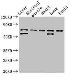 Polyclonal Rabbit anti-Human BIRC2 / cIAP1 Antibody (WB)