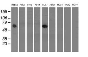 IHC-plus™ FTCD / 58K Golgi Protein Antibody (clone 7C5)