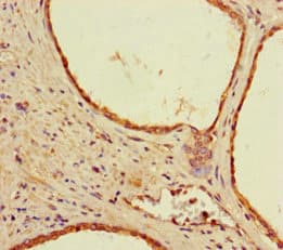 SHSF1 / SHFM1 Antibody