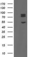 TLE1 / TLE 1 Antibody (aa180-460, clone OTI1H2, Carrier-free)
