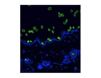 Monoclonal Mouse anti-Human Pan Cytokeratin Antibody (clone AE13, IHC, WB)