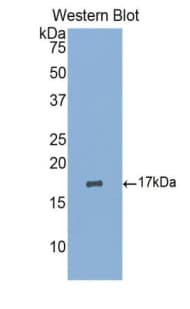 FGA / Fibrinogen Alpha Antibody (aa124-214)