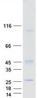 Human TM4SF19 Protein (Recombinant Myc-DDK (Flag))