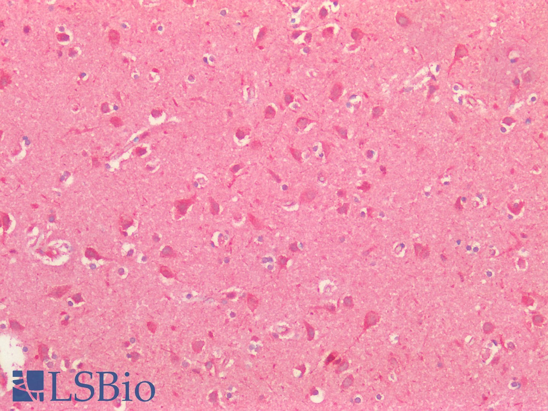 Polyclonal Rabbit anti-Human SMO / Smoothened Antibody (IHC, IF, WB)